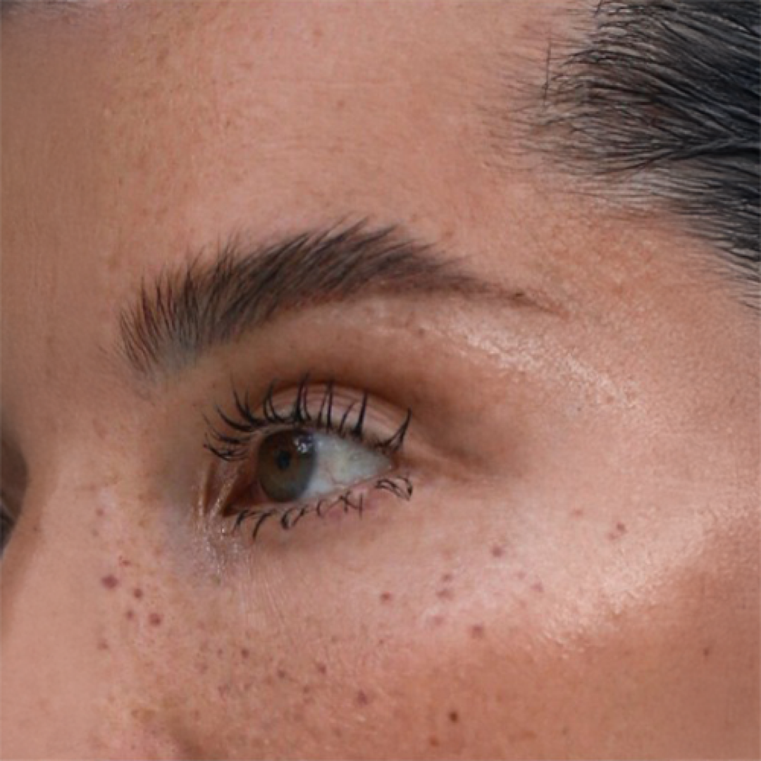 Sesudah - Eyebrow Transplant